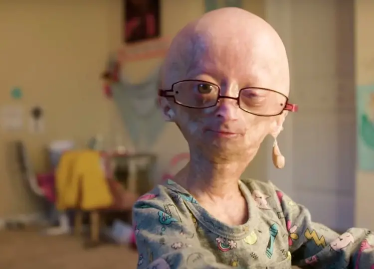 Adalia Rose Age, Wiki ( Died ? ) Parents, Mom, Baby, Family, Net Worth